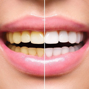 Smile Lab FLASH Speed Whitening Toothpaste